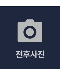 전후사진